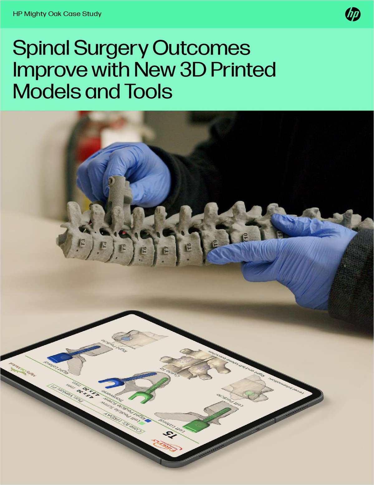 Spinal Surgery Outcomes Improve with New 3D Printed Models and Tools